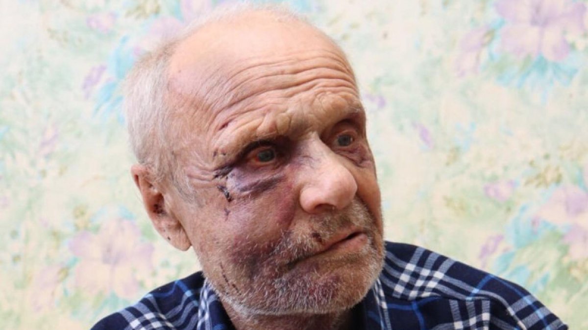 В Костанайской области 73-летнего пенсионера избили из-за денег