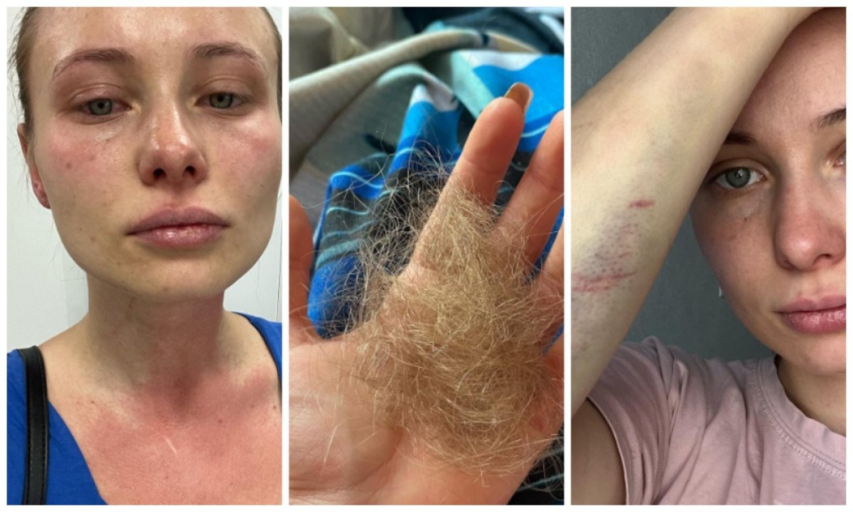 Жительницу Алматы жестоко избили в собственном подъезде