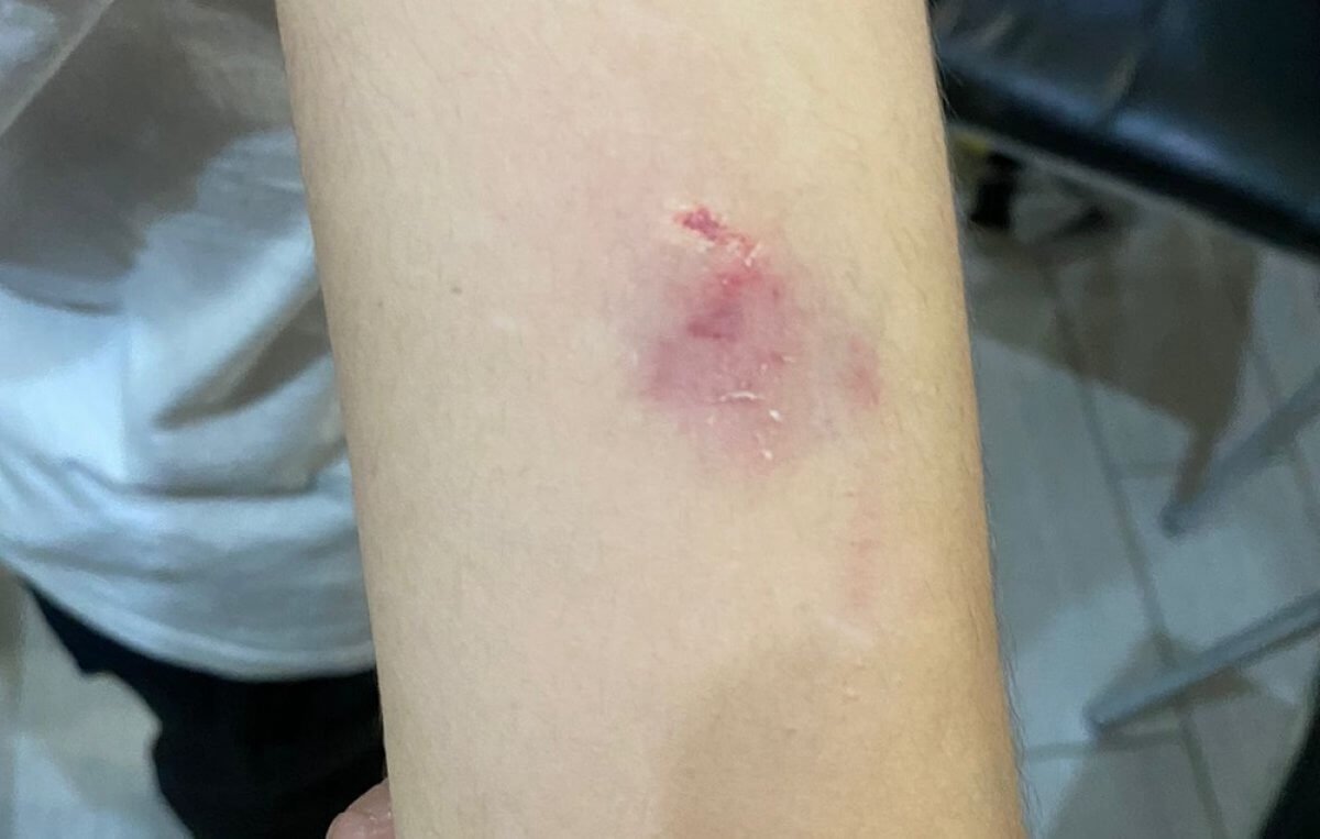 В Актау школьника покусала собака прямо во время урока