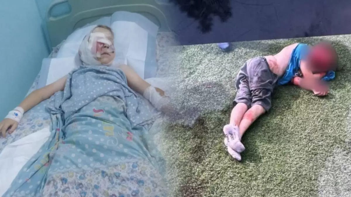 Нападение собак на детей: зоозащитники представили свою версию произошедшего