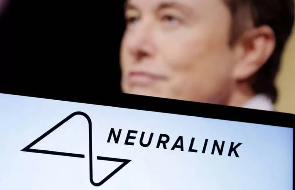 Neuralink намерен вживлять нейрочипы 20 тысячам пациентов каждый год до 2031