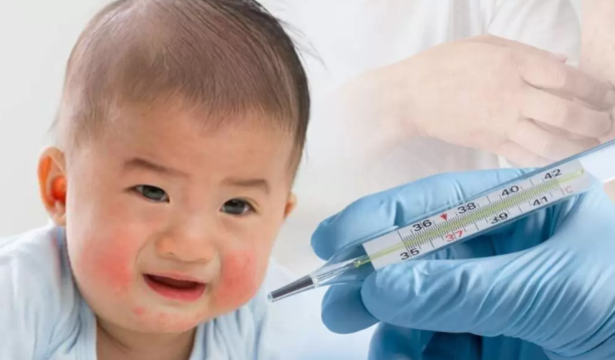 Почти две тысячи случаев кори в Казахстане с начала года: названы “регионы-лидеры”