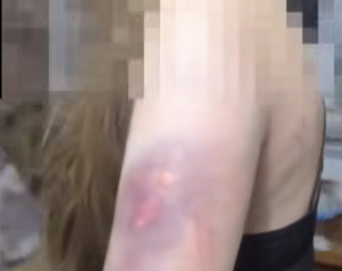 В Караганде подростки жестоко избили сверстницу