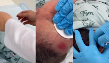 "Пытка над младенцем": в Минздраве высказались о видео с надрезами на лице ребенка