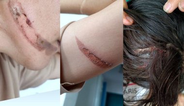Мужчина регулярно избивает жену до полусмерти в Абайской области