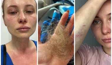 Жительницу Алматы жестоко избили в собственном подъезде