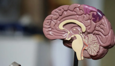 Кардиолог назвал тревожные признаки плохого кровообращения мозга