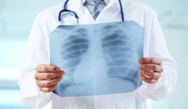 Два случая туберкулеза выявлены среди студентов в СКО