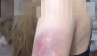 В Караганде подростки жестоко избили сверстницу