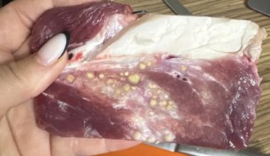 «Паразиты или гнойники?»: казахстанка пожаловалась на мясо из магазина