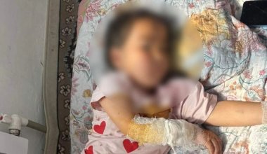 Шакал покусал ребёнка и двух взрослых в Туркестанской области